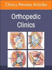 Infections An Issue Of Orthopedic Clinic By Azar, Frederick M.