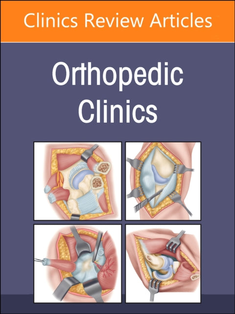 Infections An Issue Of Orthopedic Clinic By Azar, Frederick M.