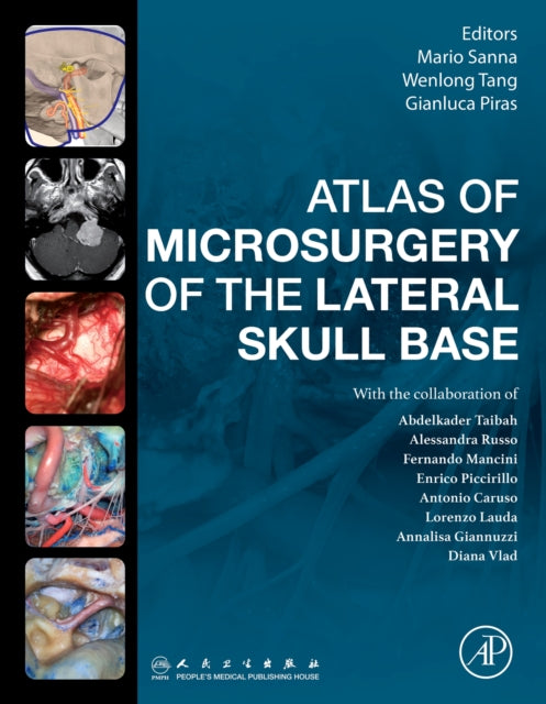 Atlas Of Microsurgery Of The Lateral Sku By Sanna,mario