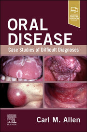 Oral Disease Case Studies Of Difficult D By Allen, Carl M.