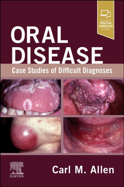 Oral Disease Case Studies Of Difficult D By Allen, Carl M.