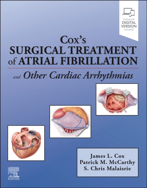 Coxs Surgical Treatment Of Atrial Fibril By Cox, James