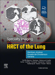 Specialty Imaging Hrct Of The Lung