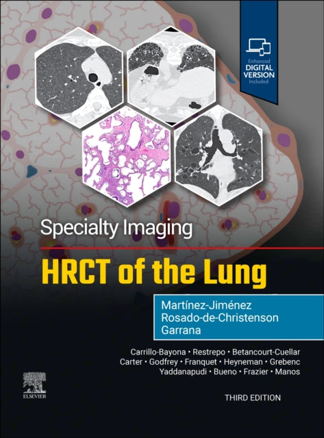Specialty Imaging Hrct Of The Lung
