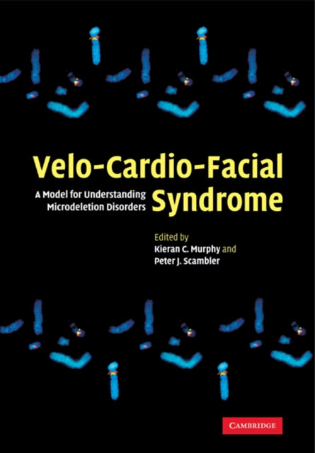 Velo-cardio-facial Syndrome