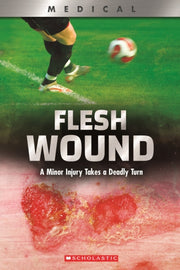 Flesh Wound