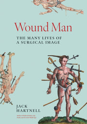 Wound Man The Many Lives Of A Surgical By Jack Hartnell