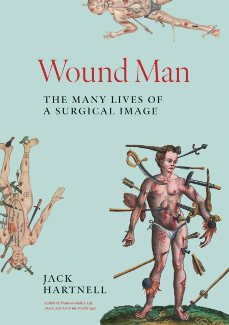 Wound Man The Many Lives Of A Surgical
