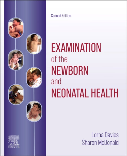 Examination Of The Newborn & Neonatal He By Davies Lorna