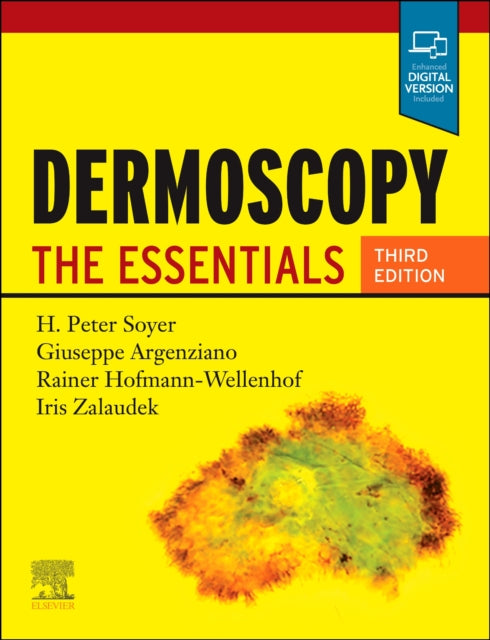 Dermoscopy By H. Peter Soyer