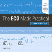 Ecg Made Practical