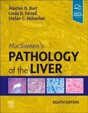 Macsweens Pathology Of The Liver