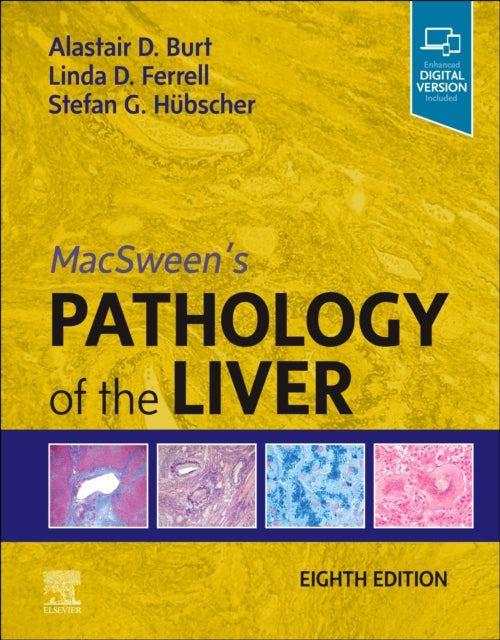 Macsweens Pathology Of The Liver