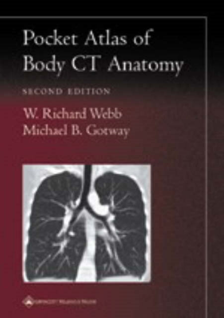 Pocket Atlas Of Body Ct Anatomy 2e