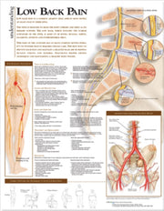 Understanding Low Back Pain Anatomical