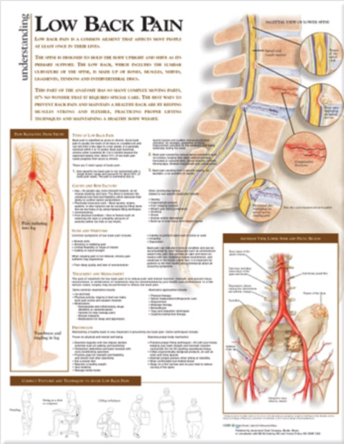 Understanding Low Back Pain Anatomical