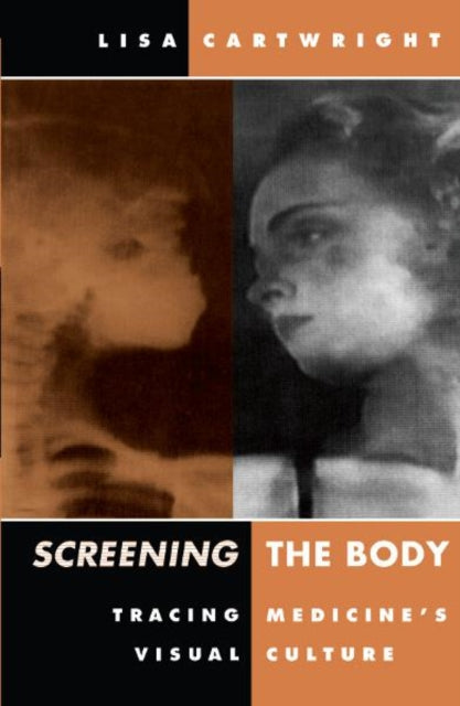 Screening The Body