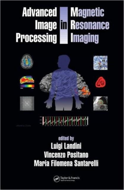 Advanced Image Processing In Magnetic Re By Luigi Landini