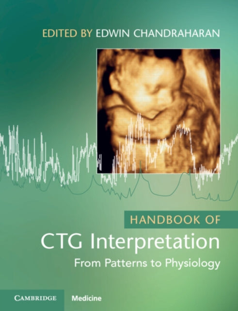 Handbook Of Ctg Interpretation By Chandraharan, Edwin