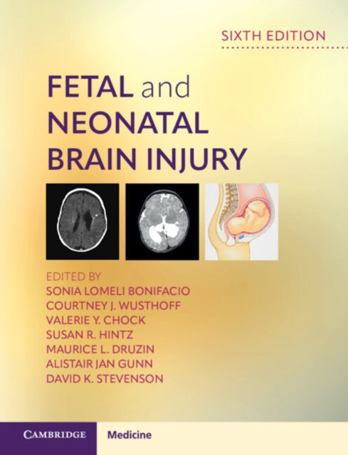 Fetal And Neonatal Brain Injury By Edited By Sonia Lome