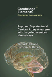 Ruptured Supratentorial Cerebral Artery