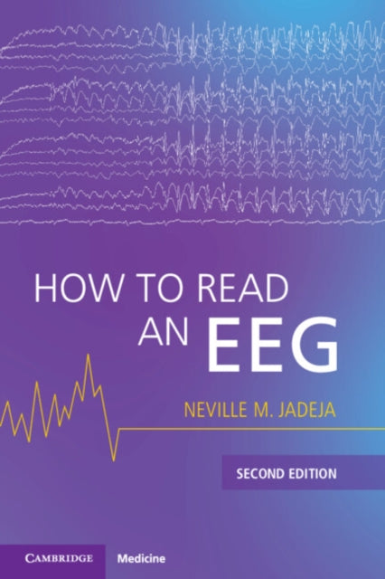 How To Read An Eeg