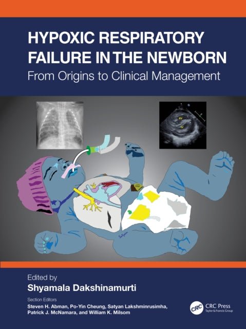 Hypoxic Respiratory Failure In The Newbo