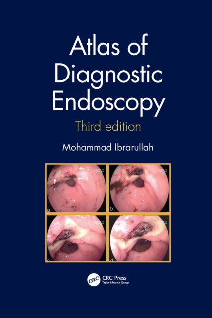 Atlas Of Diagnostic Endoscopy 3e