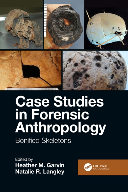 Case Studies In Forensic Anthropology