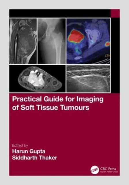 Practical Guide For Imaging Of Soft Tiss