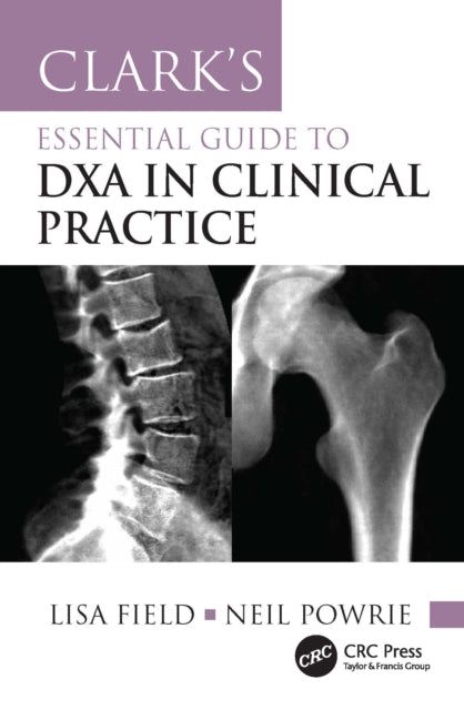 Clarks Essential Guide To Dxa In Clini By Field  Lisa
