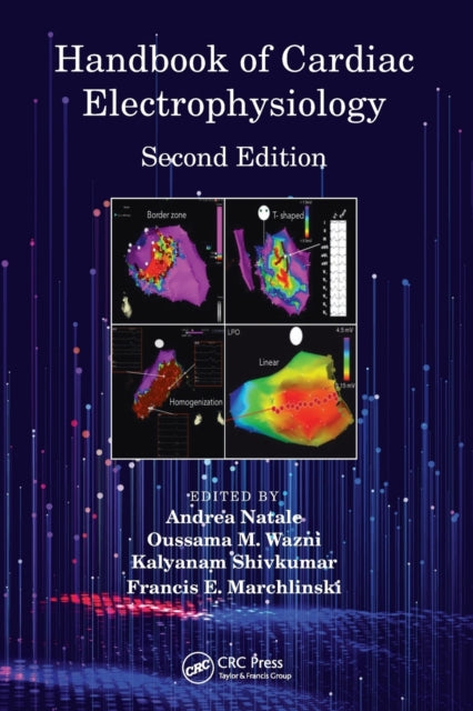 Handbook Of Cardiac Electrophysiolo By Andrea Natale