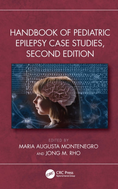 Handbook Of Pediatric Epilepsy Case Stu By Montenegro  Maria Au
