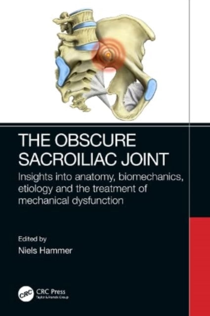 Obscure Sacroiliac Joint
