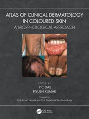 Atlas Of Clinical Dermatology In Coloure