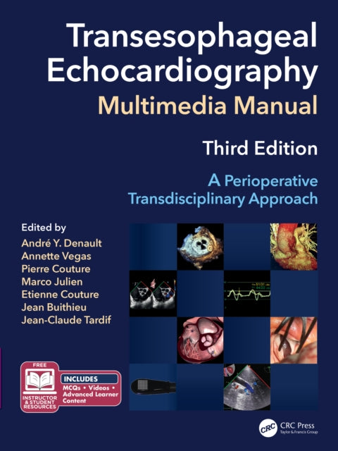 Transesophageal Echocardiography Multim By Denault Md Phd  Andr