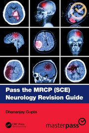 Pass The Mrcp Sce Neurology Revision By Gupta  Dhananjay
