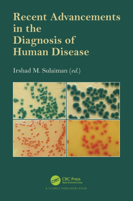 Recent Advancements In The Diagnosis Of By M. Sulaiman  Irshad