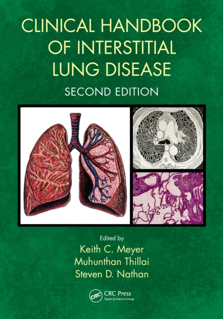 Clinical Handbook Of Interstitial Lung By Meyer  Keith C.