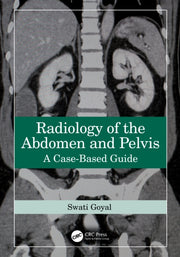 Radiology Of The Abdomen And Pelvis By Goyal  Swati