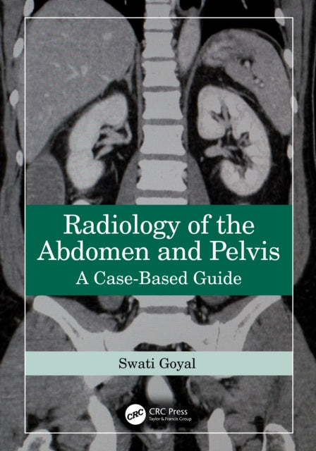 Radiology Of The Abdomen And Pelvis By Goyal  Swati