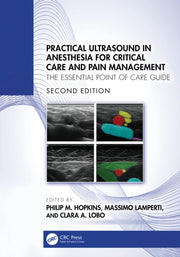 Practical Ultrasound In Anesthesia For