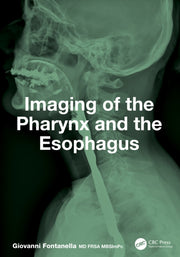 Imaging Of The Pharynx And The Esophagu By Fontanella  Giovanni