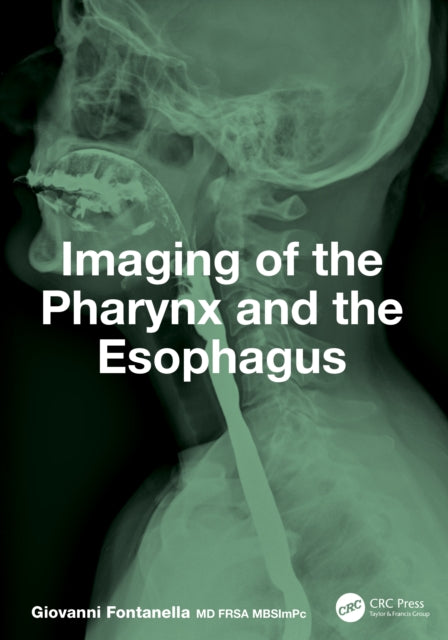 Imaging Of The Pharynx And The Esophagu By Fontanella  Giovanni