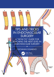 Tips And Tricks In Endovascular Surgery
