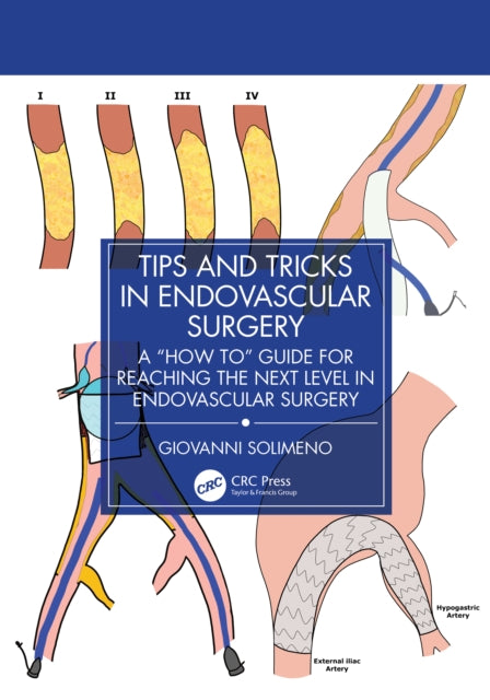 Tips And Tricks In Endovascular Surgery