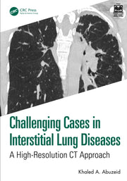 Challenging Cases In Interstitial Lung