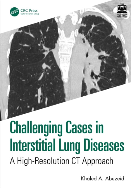 Challenging Cases In Interstitial Lung