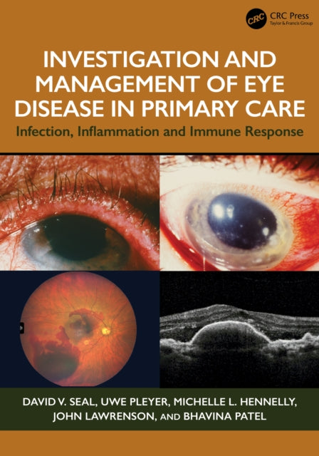 Investigation Management Of Eye Disea