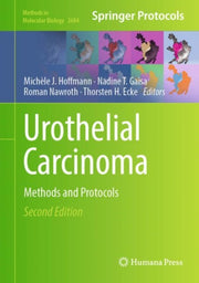 Urothelial Carcinoma : Methods And Proto